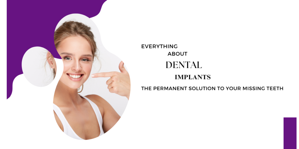 Everything about dental implants – the permanent solution to your missing teeth