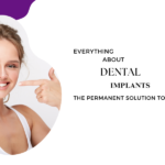 Everything about dental implants – the permanent solution to your missing teeth