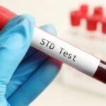 The Difference Between STDs and STIs and How to Reduce Your Risk