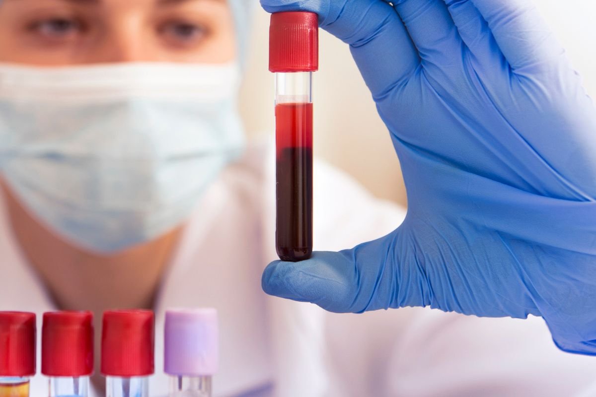 Top 10 Reasons to Choose Private Blood Tests in London