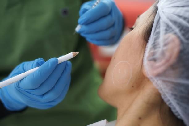 Botox injections in Dubai