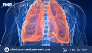 Acute Lung Injury Treatment Market